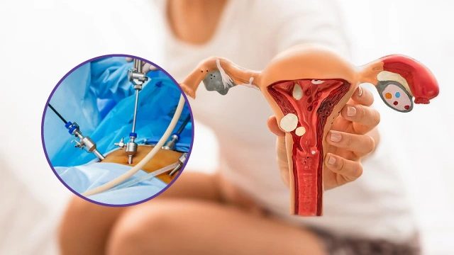 Laparoscopic gynecology surgery in Jaipur